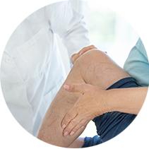Varicose veins