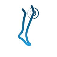 Reprezentarea articulațiilor rigide ca simptom al unei circulații sanguine deficitare